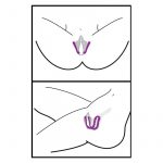 modelo separador de labios vaginales