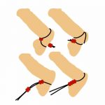 lazo erector para pene F3.