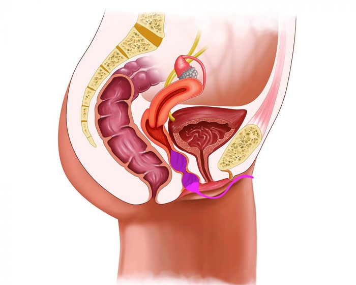 YF126-dr-fullbright-kegel-F2